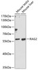 Western blot analysis of extracts of various cell lines using RAG2 Polyclonal Antibody at dilution of 1:1000.