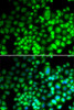 Immunofluorescence analysis of HeLa cells using ST6GAL1 Polyclonal Antibody