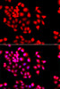 Immunofluorescence analysis of A549 cells using STXBP2 Polyclonal Antibody