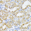 Immunohistochemistry of paraffin-embedded Human stomach using SLC30A1 Polyclonal Antibody at dilution of  1:100 (40x lens).