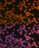 Immunofluorescence analysis of THP-1 cells using TNFRSF10A Polyclonal Antibody at dilution of  1:100 (40x lens). Blue: DAPI for nuclear staining.