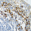 Immunohistochemistry of paraffin-embedded Human tonsil using Bim Polyclonal Antibody at dilution of  1:100 (40x lens).