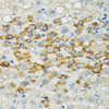 Immunohistochemistry of paraffin-embedded Human liver using Bim Polyclonal Antibody at dilution of  1:100 (40x lens).
