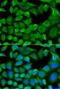 Immunofluorescence analysis of HeLa cells using Bim Polyclonal Antibody