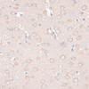 Immunohistochemistry of paraffin-embedded Mouse brain using ABCF2 Polyclonal Antibody at dilution of  1:100 (40x lens).