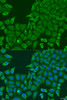 Immunofluorescence analysis of U2OS cells using ABCF2 Polyclonal Antibody at dilution of  1:100. Blue: DAPI for nuclear staining.