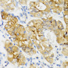 Immunohistochemistry of paraffin-embedded Human stomach using GHRL Polyclonal Antibody at dilution of  1:100 (40x lens).