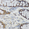 Immunohistochemistry of paraffin-embedded Human rectum using GHRL Polyclonal Antibody at dilution of  1:100 (40x lens).