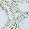 Immunohistochemistry of paraffin-embedded Human colon using METTL13 Polyclonal Antibody at dilution of  1:100 (40x lens).