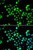 Immunofluorescence analysis of A549 cells using METTL13 Polyclonal Antibody