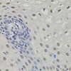 Immunohistochemistry of paraffin-embedded Human esophagus using MKL1 Polyclonal Antibody