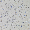 Immunohistochemistry of paraffin-embedded Mouse brain using MKL1 Polyclonal Antibody