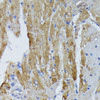 Immunohistochemistry of paraffin-embedded Mouse heart using ACADL Polyclonal Antibody at dilution of  1:100 (40x lens).