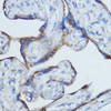 Immunohistochemistry of paraffin-embedded Human placenta using Aromatase Polyclonal Antibody at dilution of  1:100 (40x lens).