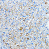 Immunohistochemistry of paraffin-embedded Rat ovary using Aromatase Polyclonal Antibody at dilution of  1:100 (40x lens).