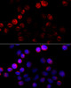 Immunofluorescence analysis of HeLa cells using Aromatase Polyclonal Antibody at dilution of  1:100 (40x lens). Blue: DAPI for nuclear staining.