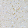 Immunohistochemistry of paraffin-embedded Rat brain using MAP2K1 Polyclonal Antibody at dilution of  1:100 (40x lens).