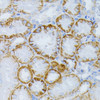 Immunohistochemistry of paraffin-embedded Mouse kidney using MAP2K1 Polyclonal Antibody at dilution of  1:100 (40x lens).