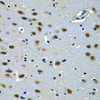 Immunohistochemistry of paraffin-embedded Rat brain using PAX7 Polyclonal Antibody at dilution of  1:100 (40x lens).