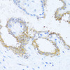 Immunohistochemistry of paraffin-embedded Human breast using NAT2 Polyclonal Antibody at dilution of  1:100 (40x lens).