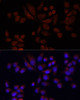 Immunofluorescence analysis of 293T cells using NAT2 Polyclonal Antibody at dilution of  1:100 (40x lens). Blue: DAPI for nuclear staining.