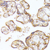 Immunohistochemistry of paraffin-embedded Human placenta using VEGF Receptor 1 Polyclonal Antibody at dilution of  1:100 (40x lens).