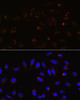 Immunofluorescence analysis of U-2 OS cells using Mitofusin 2 Polyclonal Antibody at dilution of  1:100. Blue: DAPI for nuclear staining.