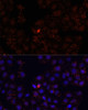 Immunofluorescence analysis of HeLa cells using WDR81 Polyclonal Antibody at dilution of  1:100. Blue: DAPI for nuclear staining.