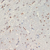 Immunohistochemistry of paraffin-embedded Rat brain using OLIG2 Polyclonal Antibody at dilution of  1:200 (40x lens).
