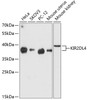 Western blot analysis of extracts of various cell lines using KIR2DL4 Polyclonal Antibody at dilution of 1:3000.