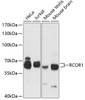 Western blot analysis of extracts of various cell lines using RCOR1 Polyclonal Antibody at dilution of 1:3000.