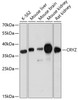 Western blot analysis of extracts of various cell lines using CRYZ Polyclonal Antibody at dilution of 1:3000.