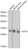 Western blot analysis of extracts of various cell lines using GSTT1 Polyclonal Antibody at dilution of 1:1000.