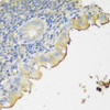 Immunohistochemistry of paraffin-embedded Human appendix using CLN5 Polyclonal Antibody at dilution of  1:150 (40x lens).