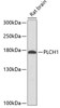 Western blot analysis of extracts of Rat brain using PLCH1 Polyclonal Antibody at dilution of 1:3000.