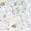 Immunohistochemistry of paraffin-embedded Rat brain using IFNL3 Polyclonal Antibody at dilution of  1:100 (40x lens).