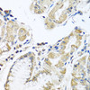 Immunohistochemistry of paraffin-embedded Human stomach using IFNL3 Polyclonal Antibody at dilution of  1:100 (40x lens).