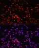 Immunofluorescence analysis of NIH-3T3 cells using DKC1 Polyclonal Antibody at dilution of  1:100. Blue: DAPI for nuclear staining.