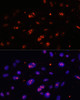 Immunofluorescence analysis of U-2 OS cells using DKC1 Polyclonal Antibody at dilution of  1:100. Blue: DAPI for nuclear staining.