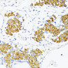 Immunohistochemistry of paraffin-embedded Rat ovary using Fibronectin Polyclonal Antibody at dilution of  1:100 (40x lens).