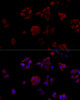 Immunofluorescence analysis of HeLa cells using CD40L Polyclonal Antibody at dilution of  1:100. Blue: DAPI for nuclear staining.