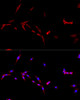 Immunofluorescence analysis of PC-12 cells using CD40L Polyclonal Antibody at dilution of  1:100. Blue: DAPI for nuclear staining.