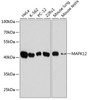 Western blot analysis of extracts of various cell lines using MAPK12 Polyclonal Antibody at dilution of 1:10000.