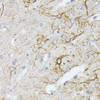 Immunohistochemistry of paraffin-embedded Rat brain using TBCA Polyclonal Antibody at dilution of  1:100 (40x lens).