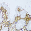 Immunohistochemistry of paraffin-embedded Human stomach using GCN1L1 Polyclonal Antibody at dilution of  1:150 (40x lens).