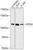 Western blot analysis of extracts of various cell lines using VPS39 Polyclonal Antibody at dilution of 1:3000.