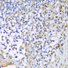 Immunohistochemistry of paraffin-embedded Human tonsil using A1CF Polyclonal Antibody at dilution of  1:100 (40x lens).