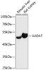 Western blot analysis of extracts of various cell lines using AADAT Polyclonal Antibody at dilution of 1:3000.