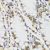 Immunohistochemistry of paraffin-embedded Human colon using CASC5 Polyclonal Antibody at dilution of  1:100 (40x lens).