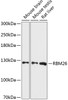Western blot analysis of extracts of various cell lines using RBM26 Polyclonal Antibody at dilution of 1:3000.